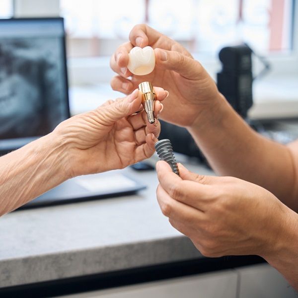 Dental Implants at EverSmile Dental Care